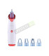Мощен вакуум уред за черни точки