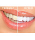 Писалка за избелване на зъби - Teeth Whitening Pen