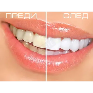 Писалка за избелване на зъби - Teeth Whitening Pen
