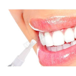 Писалка за избелване на зъби - Teeth Whitening Pen