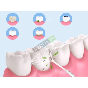Акумулаторен орален душ