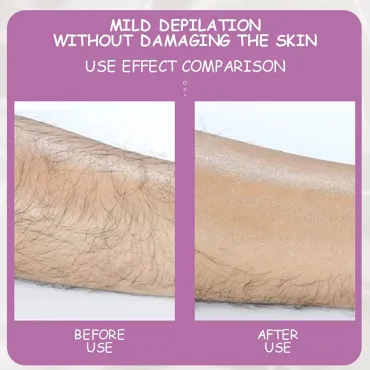Уред за безболезнено обезкосмяване - Crystal Hair Removal