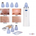 Ocisuvac-por-dla-oblicca-vid-cornih-krapok-Comedo-Suction-492458