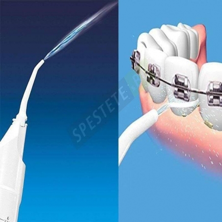 Sistema-za-pocistvane-na-zbi-Power-Floss-17-02-18-Power-Floss